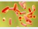 大肠杆菌的检测方法知多少