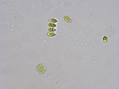 生物显微镜下观察到的绿藻成像